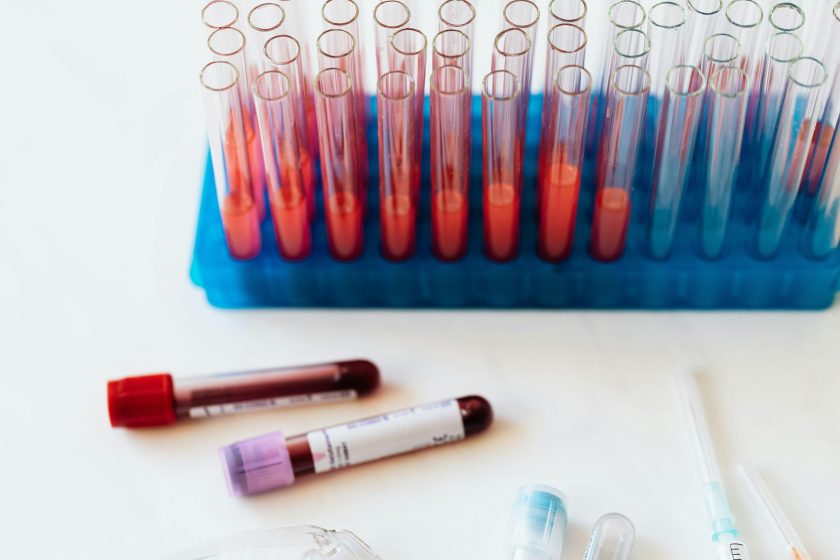 l’immagine rappresenta delle provette in un laboratorio per analisi mediche